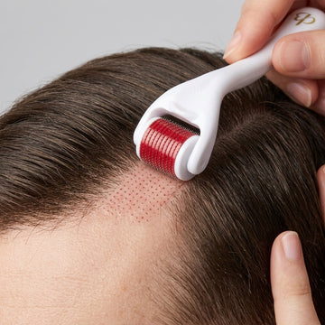 Hair Growth Serum with Derma Roller: How It Works + Ingredient Benefits